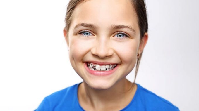¿A Partir De Qué Edad Se Puede Poner La Ortodoncia Infantil?